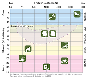 Audiograma de sonidos familiares.